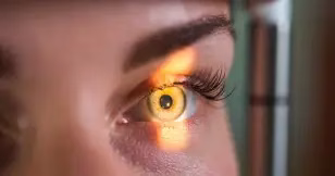 Doenças oculares raras Doenças oculares raras